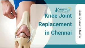 Knee joint replacement in Chennai