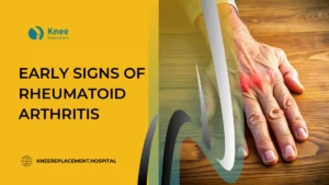 Early Signs of Rheumatoid Arthritis