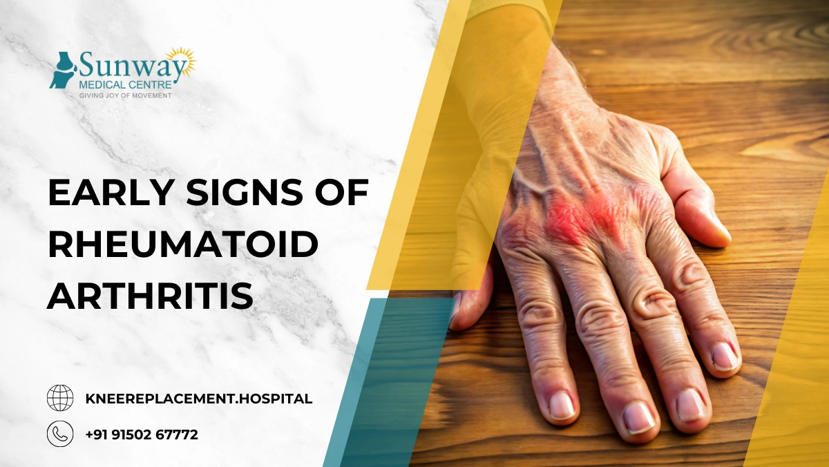 Early Signs of Rheumatoid Arthritis