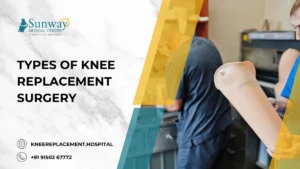 Types of Knee Replacement Surgery