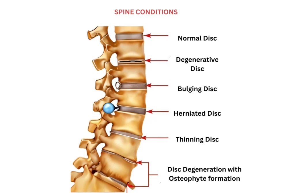 Orthopedic Physical Therapy 1 Orthopedic Physical Therapy