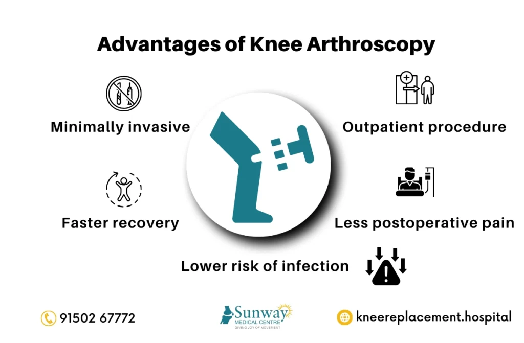 Knee Arthroscopy Recovery Time
