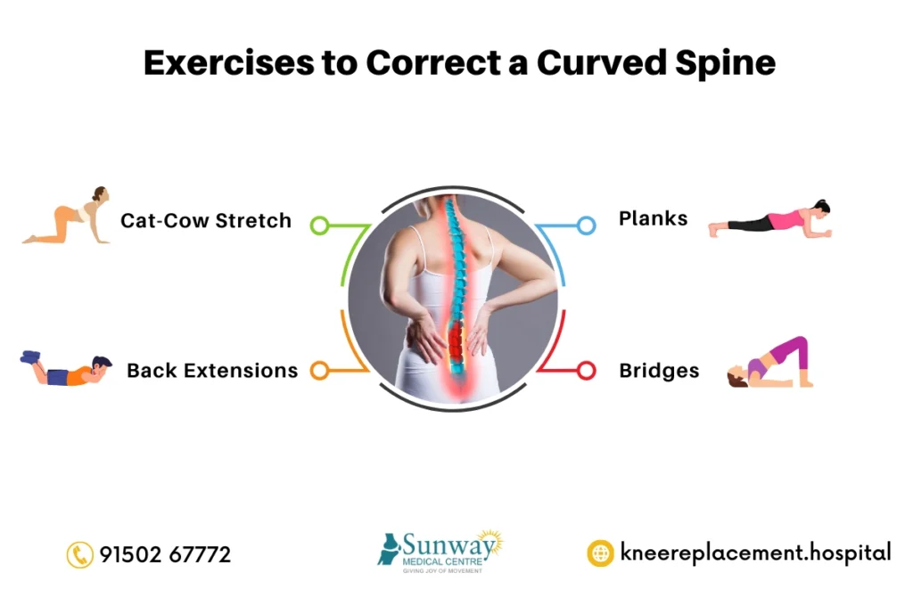 How to Fix a Curved Spine 1 how to fix a curved spine