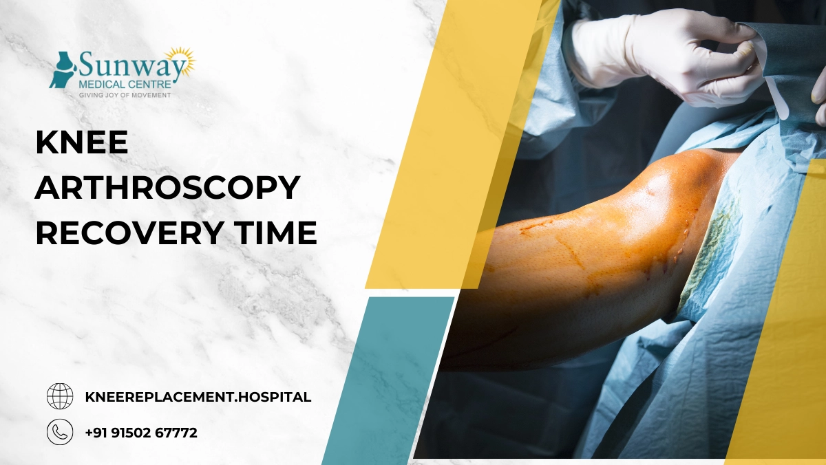 Knee Arthroscopy Recovery Time