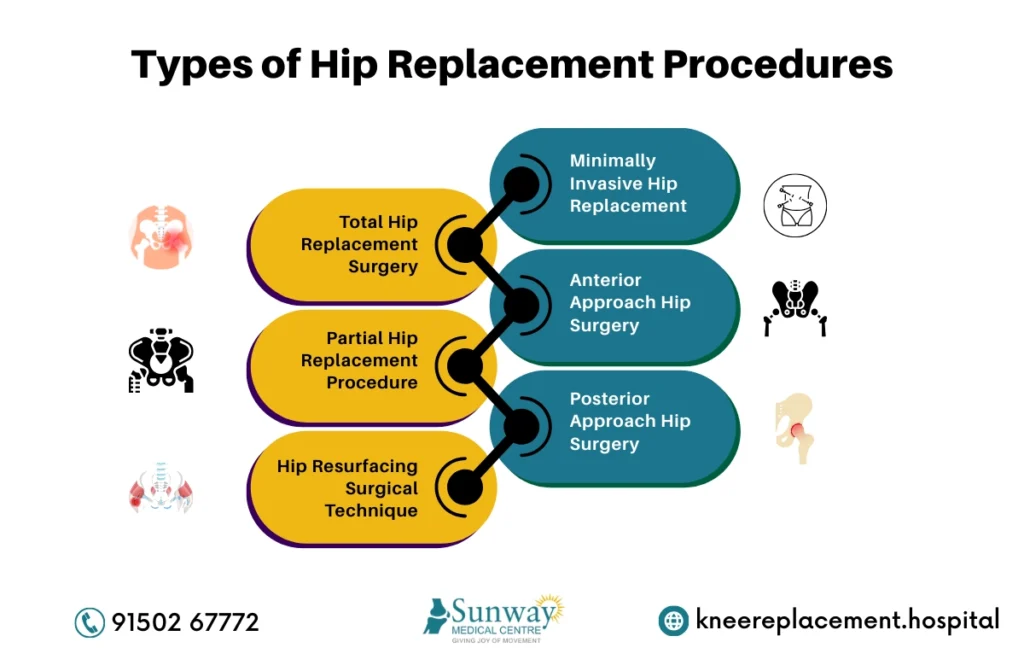 Hip Replacement Surgery in Chennai 1 Hip Replacement Surgery in Chennai