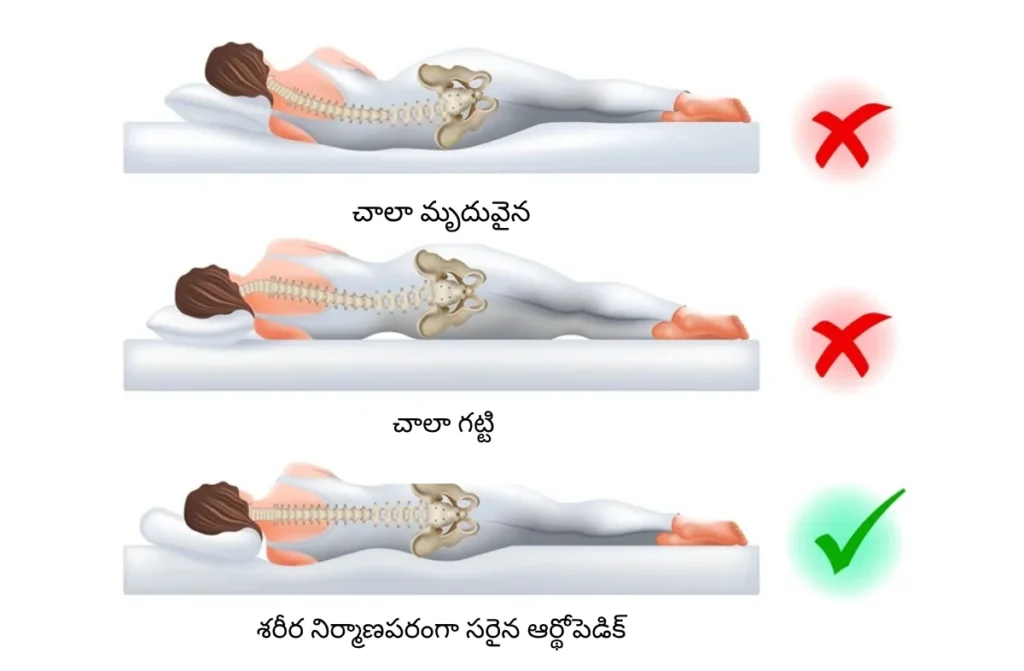 నిద్రపోయే సమయంలో వెన్నెముక నొప్పిని నివారించటం ఎలా 1 నిద్రపోయే సమయంలో వెన్నెముక నొప్పిని నివారించటం ఎలా