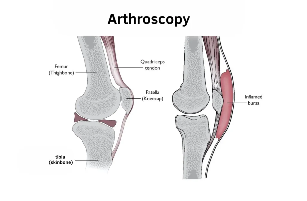 Arthroscopy Surgeon in Chennai 1 Arthroscopy Surgeon in Chennai